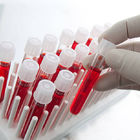 Фото: Анализы на гормоны при бесплодии