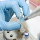 Фото: Анализ на антиспермальные антитела