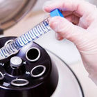 Фото: Спермограмма MAR-тест