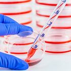 Фото: Анализы на антитела при бесплодии